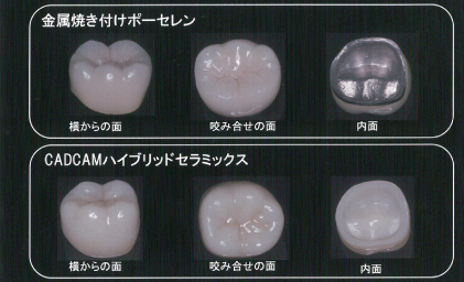 写真：診断用モニター